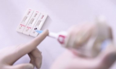 Coronavirus : Οι ΗΠΑ ενέκριναν επίσημα το πρώτο τεστ ανίχνευσης αντισωμάτων