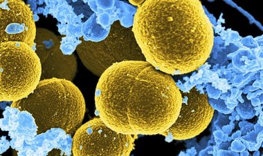 Coronavirus Disease: 354 νέα περιστατικά μόλυνσης – 78 νοσηλεύονται διασωληνωμένοι, 3 νέοι θάνατοι