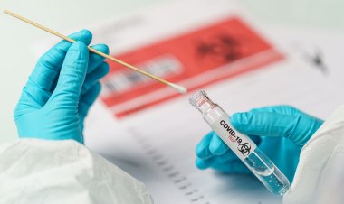 Covid-19 self-testing: Δωρεάν self test σε Super Market, Καταστήματα, Εστίαση, Δικαστήρια και Οδηγούς!! Ποιοι το δικαιούνται, πότε θα ισχύσει!!