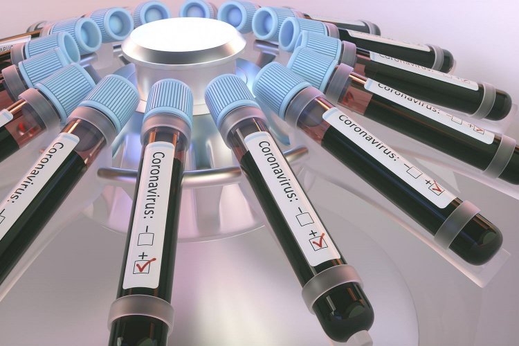 Να μην «ευελπιστούμε» ότι η ζέστη θα περιορίσει την εξάπλωση του Κορονοϊού, συμβουλεύουν οι ειδικοί