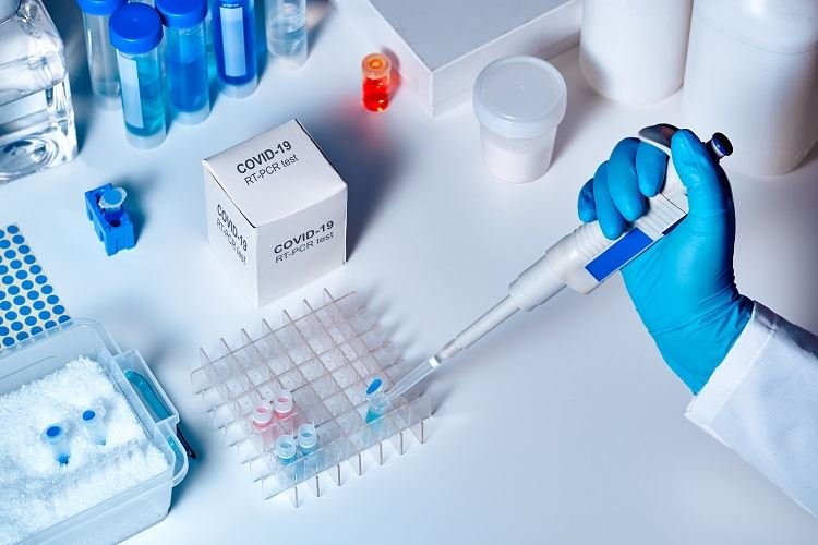 COVID-19 diagnostic testing: Τα μοριακά τεστ για κορωνοϊό είναι πιθανότερο να βγουν θετικά αν γίνουν λίγο μετά το μεσημέρι