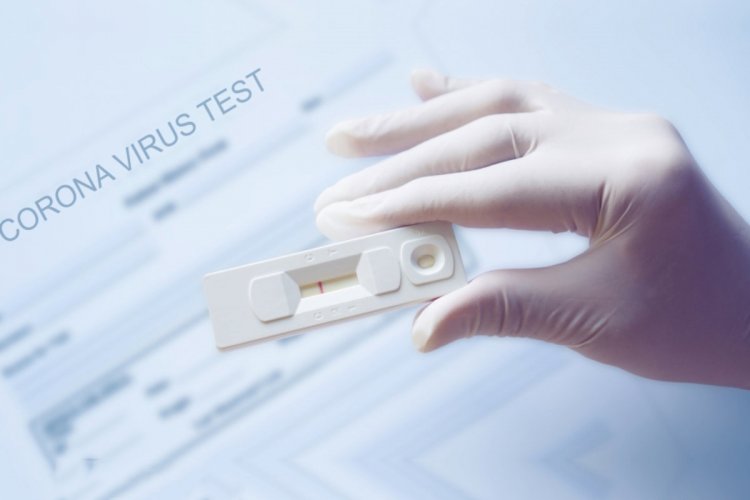 Covid-19 self-testing: Τι πρέπει να κάνουμε αν το test βγει άκυρο!! Για την Μύκονο στο Κέντρο Υγείας 9:00-15:00 τα επαναληπτικά test!!