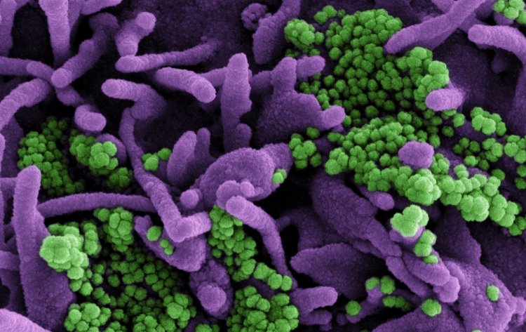 Dr. Fauci-Delta variant: Η παραλλαγή Δέλτα η μεγαλύτερη απειλή στην μάχη των ΗΠΑ για την εξάλειψη της πανδημίας εντός των συνόρων