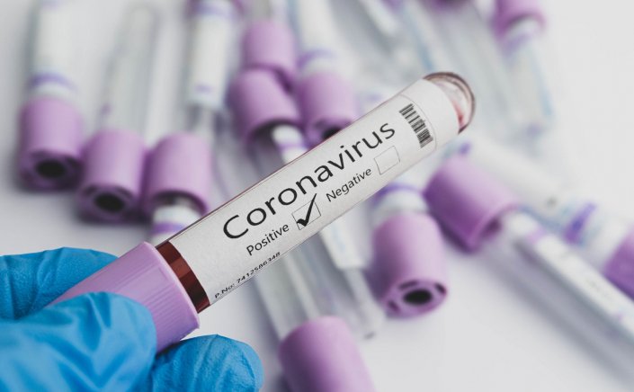 Covid-19 self-testing: Νέο σκάνδαλο με κύκλωμα που μοιράζει Πλαστά Πιστοποιητικά και Rapid Test με 200 euro [Video]