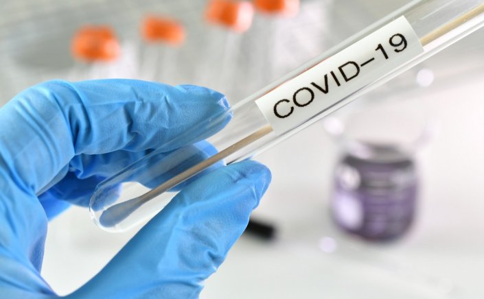 Προσοχή!! Ο ΕΟΦ άμεσα απαγορεύει τη διακίνηση και διάθεση self test Κορωνοϊού!!