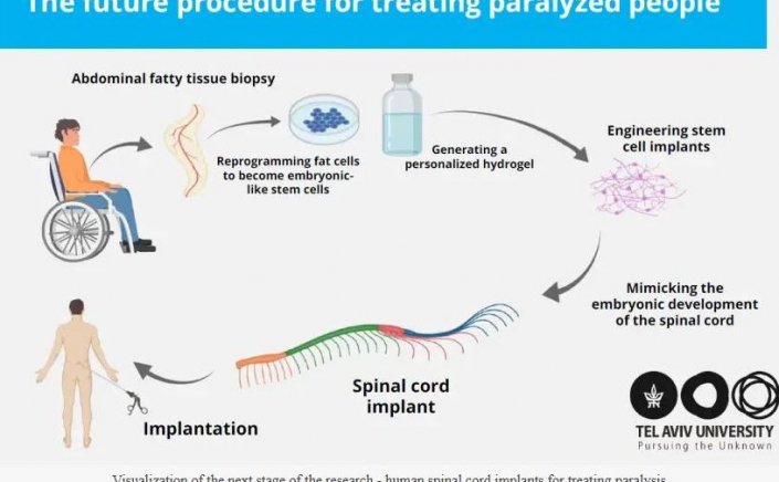 3D human spinal cord: Τα πρώτα βιοτεχνολογικά εμφυτεύματα σπονδυλικής στήλης για θεραπεία της παράλυσης δημιούργησαν επιστήμονες