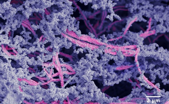 New biomaterial: Επανάσταση στην Ορθοπαιδική!! Νέο βιοϋλικό αναγεννά τον κατεστραμμένο χόνδρο στις αρθρώσεις