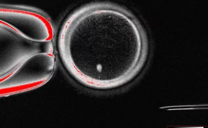 Scientists create human eggs using skin cells: Δημιουργήθηκαν ανθρώπινα έμβρυα από δερματικά κύτταρα, εξέλιξη που φέρνει επανάσταση στην ανθρώπινη αναπαραγωγή